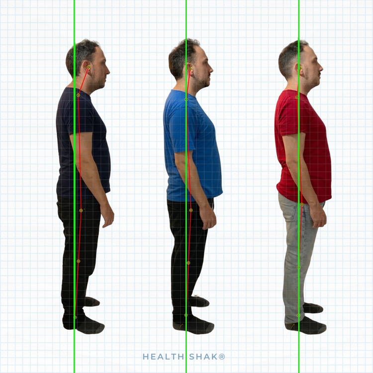 Progression of a man's posture from slouched to upright, shown in three side views against a grid background, with lines indicating spinal alignment and posture improvement.