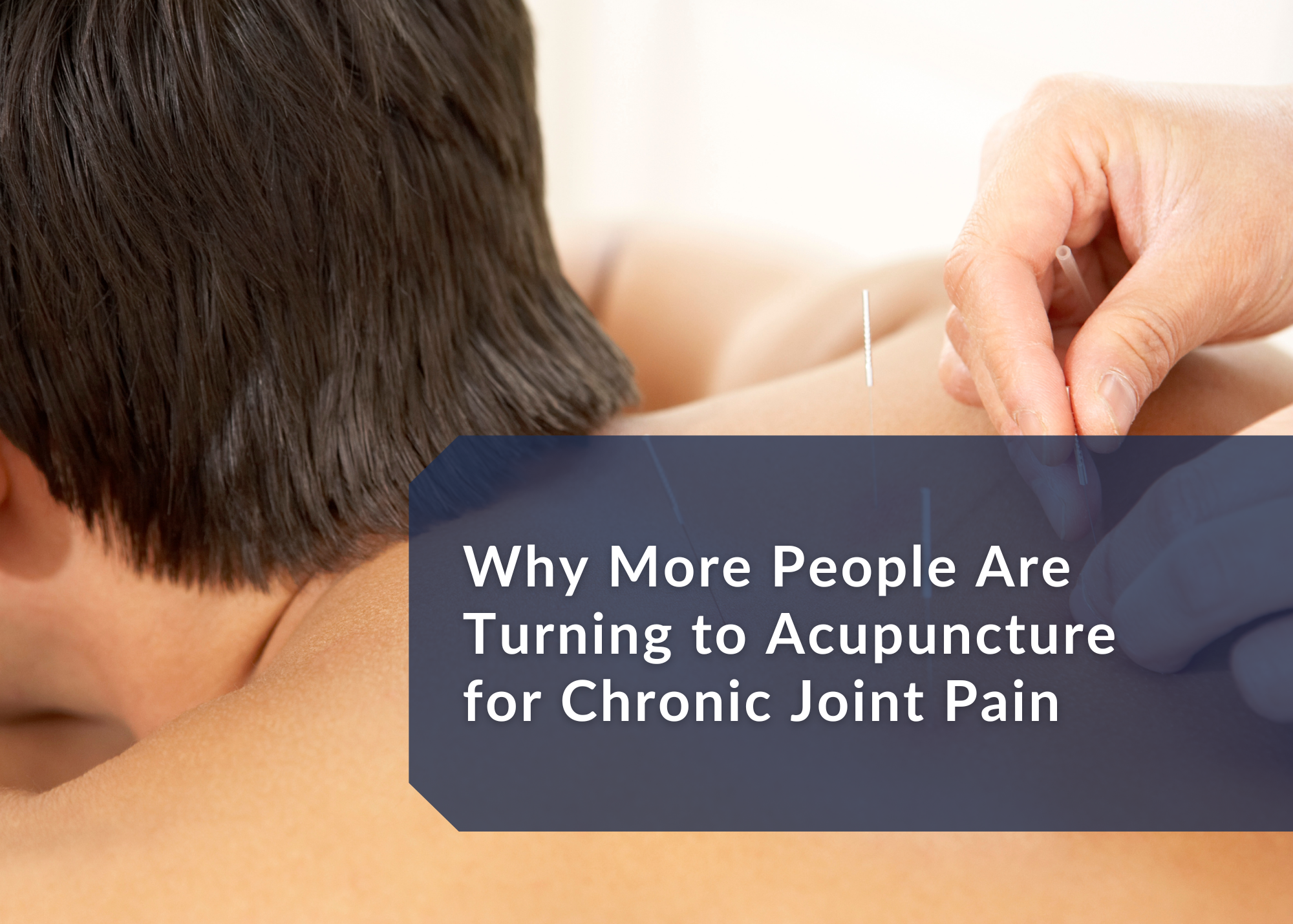 Can Acupuncture Really Help with Chronic Joint Pain? Here’s What You Should Know