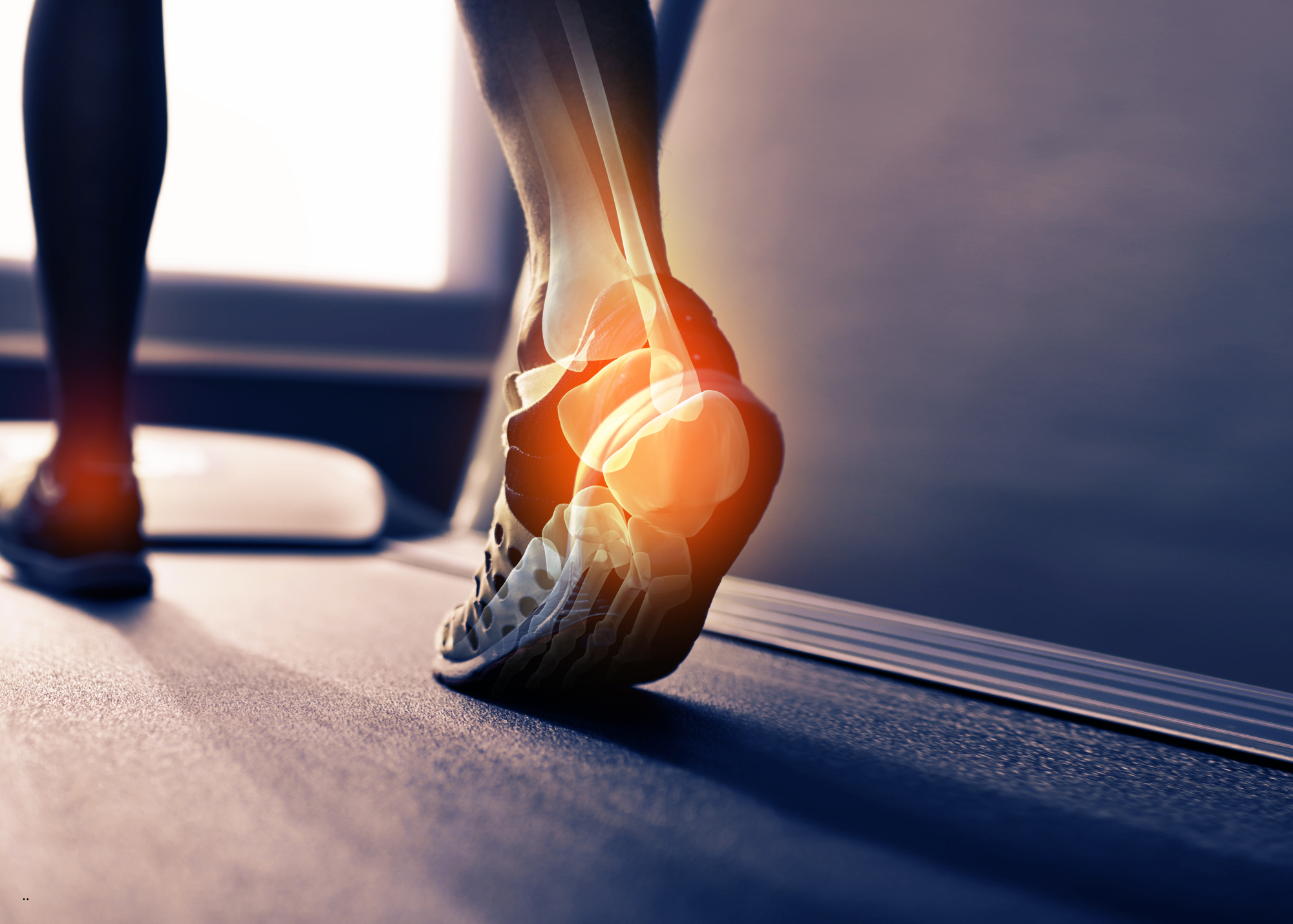Say Goodbye to Heel Pain: How to Treat Plantar Fasciitis Without Surgery or Medication