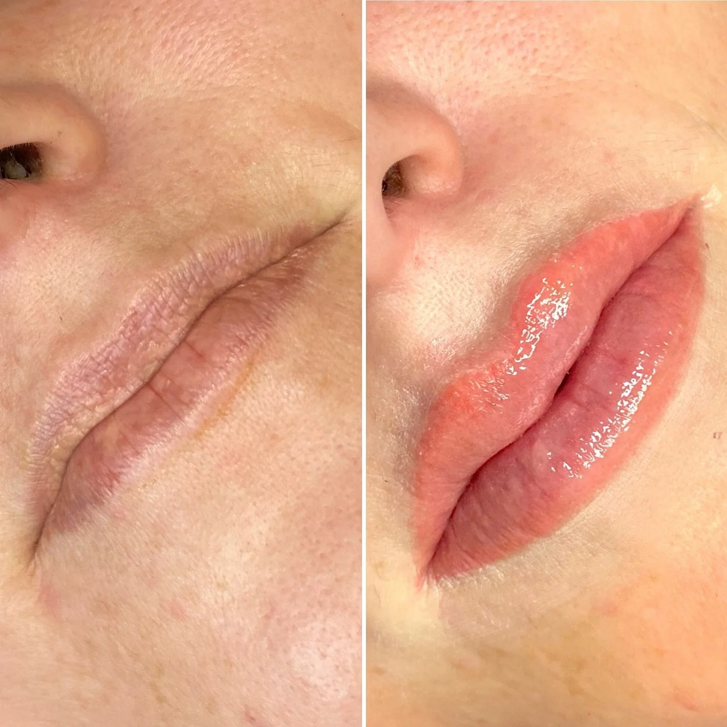 Close-up comparison of lips before and after applying lip gloss, left side showing natural lips, right side showing glossy lips.