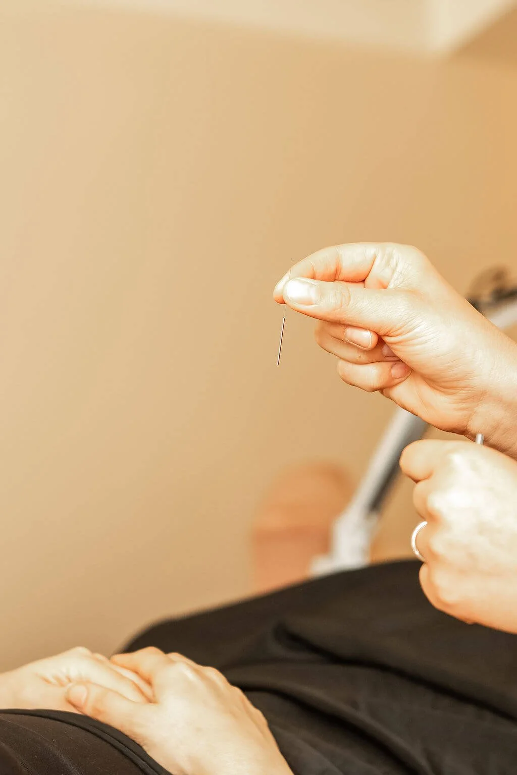 When should I start fertility acupuncture?