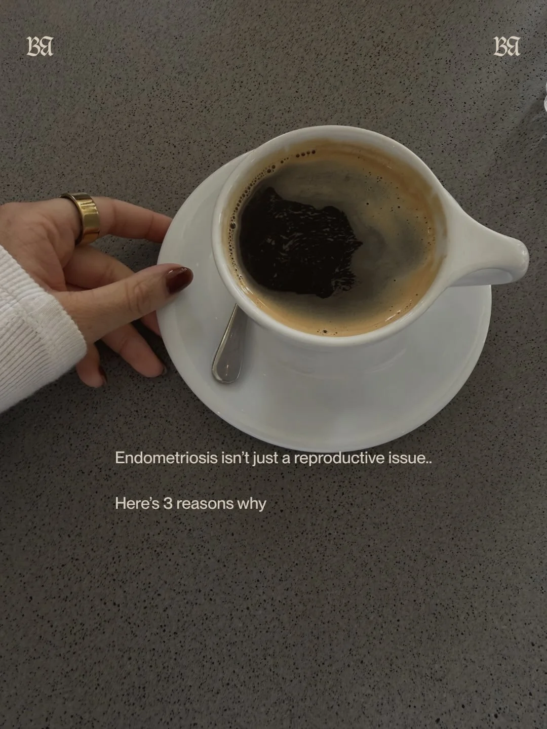 Endometriosis goes deeper than just your hormones !

Drop any endo questions you have below 👇🏽🫶🏼