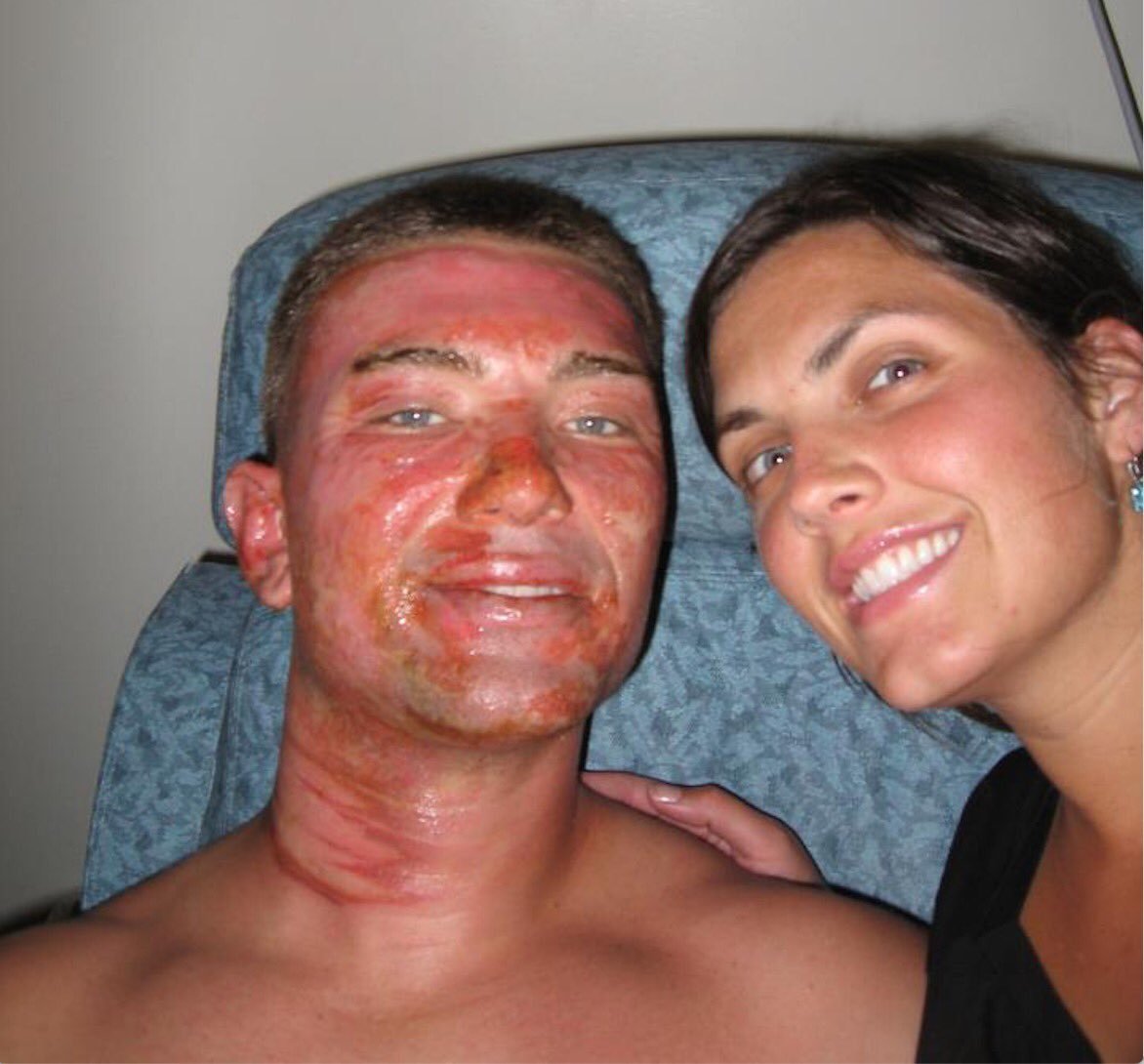 Garrett and Carrie in the burn ward. 12% of Garrett's body was covered in 2nd and 3rd degree burns.