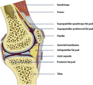 Knee Fat Pad Impingement - Symptoms, Causes and Treatment