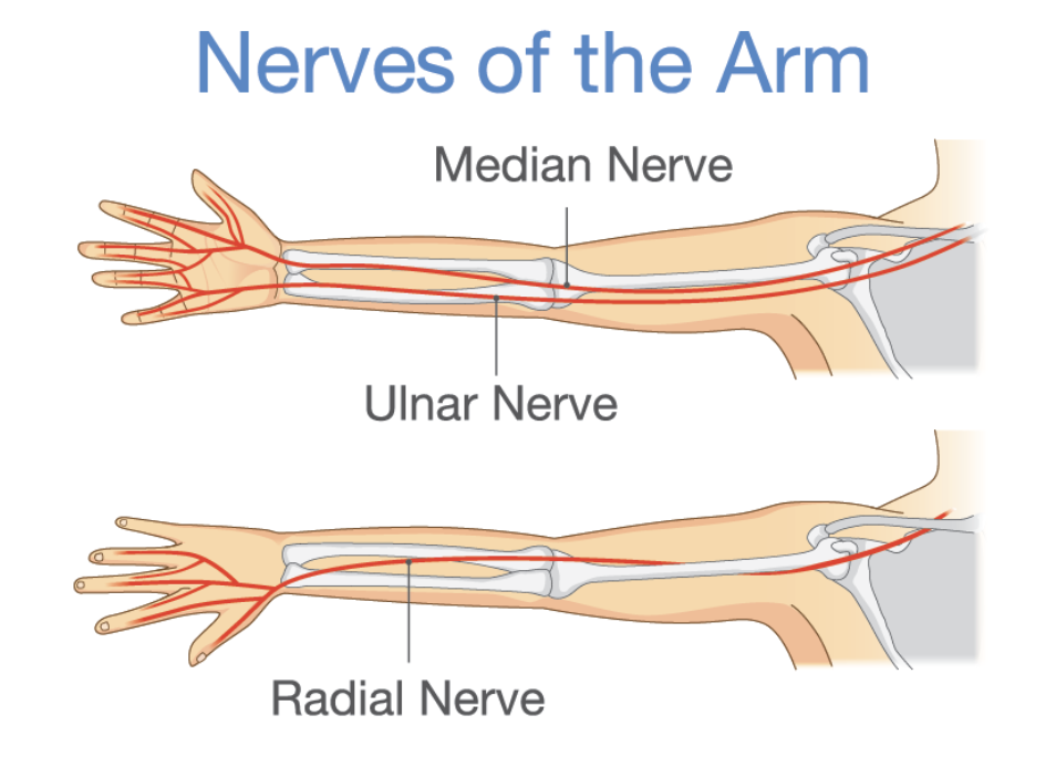 Median Nerve Entrapment, It's More Than Carpal Tunnel