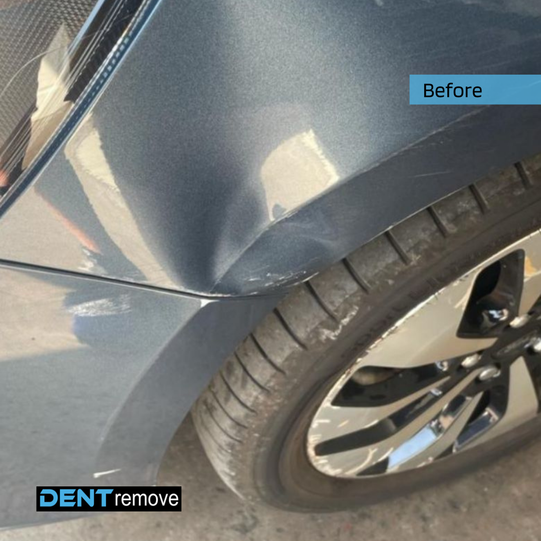Dent Remove .png
