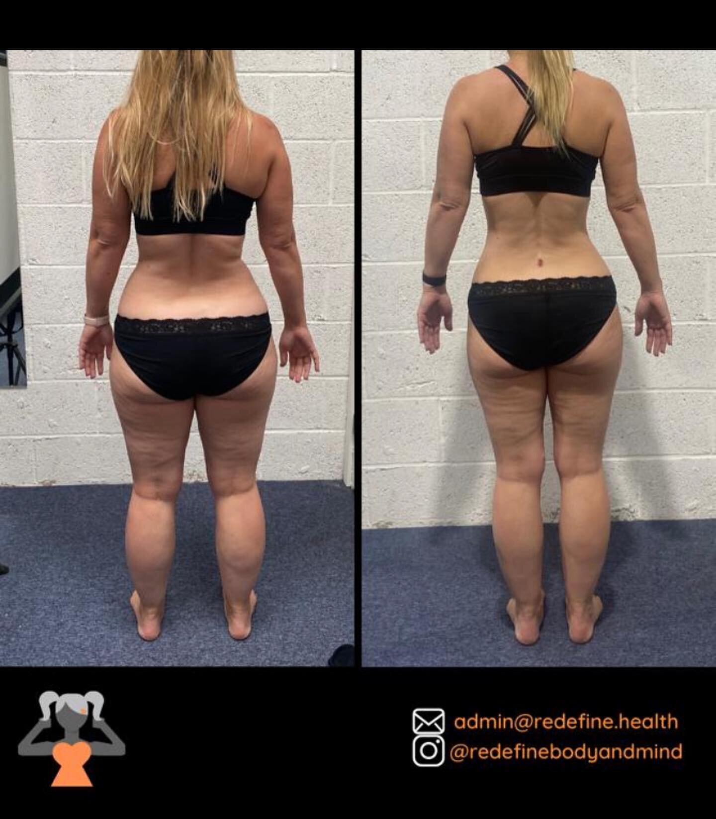 Next up in the series of our incredible &rsquo;REDEFINE YOURSELF&rsquo; 12 Week Challenge team is a lady who wants to remain anonymous for now. 

However, these before and redefine&rsquo; pictures tell the story perfect without you knowing her name! 