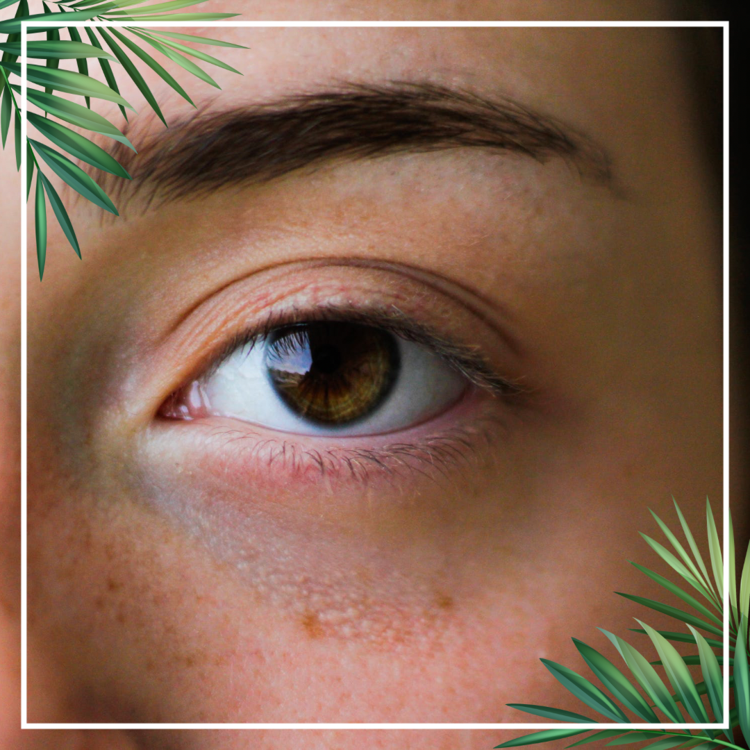 Serupa Tapi Tak Sama: Perbedaan Kantung Mata dan Mata Panda