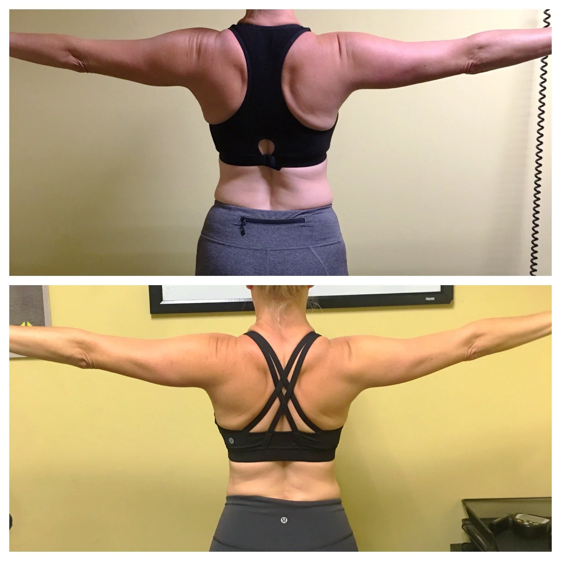 female-weight-loss-front-dr-phillips-personal-training.jpg.JPG