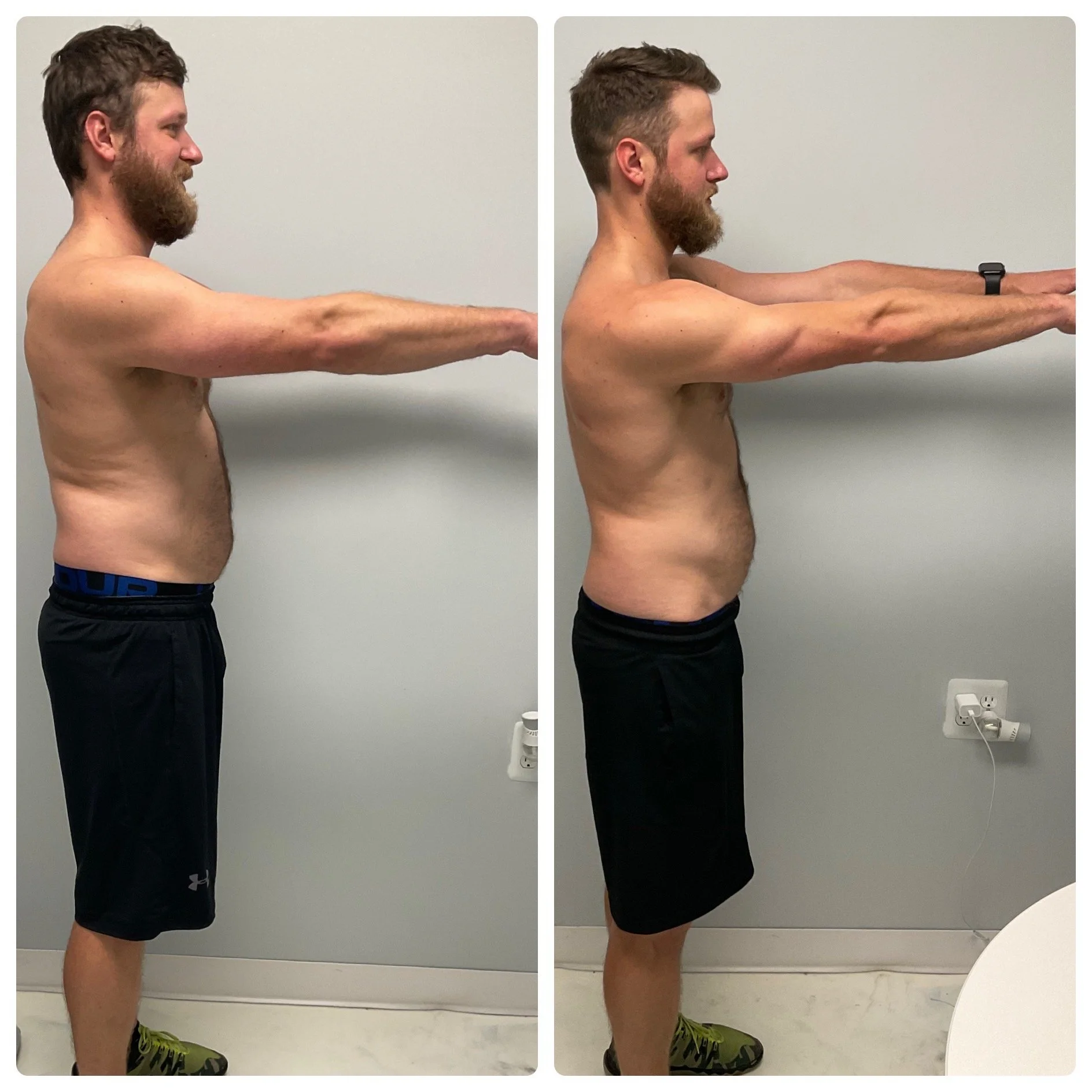 male-side-progress-photo-dr-phillips-personal-training.jpg.JPG