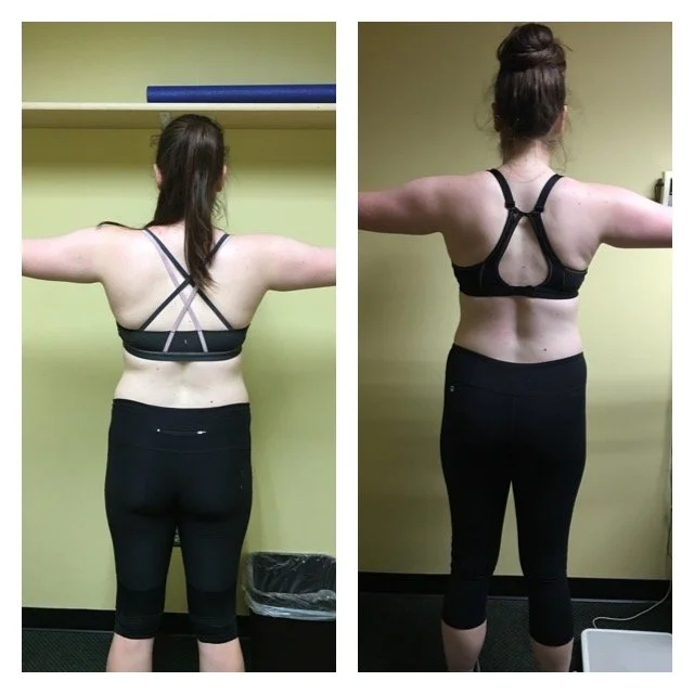 female-back-progress-photo-orlando-personal-training.jpg.JPG
