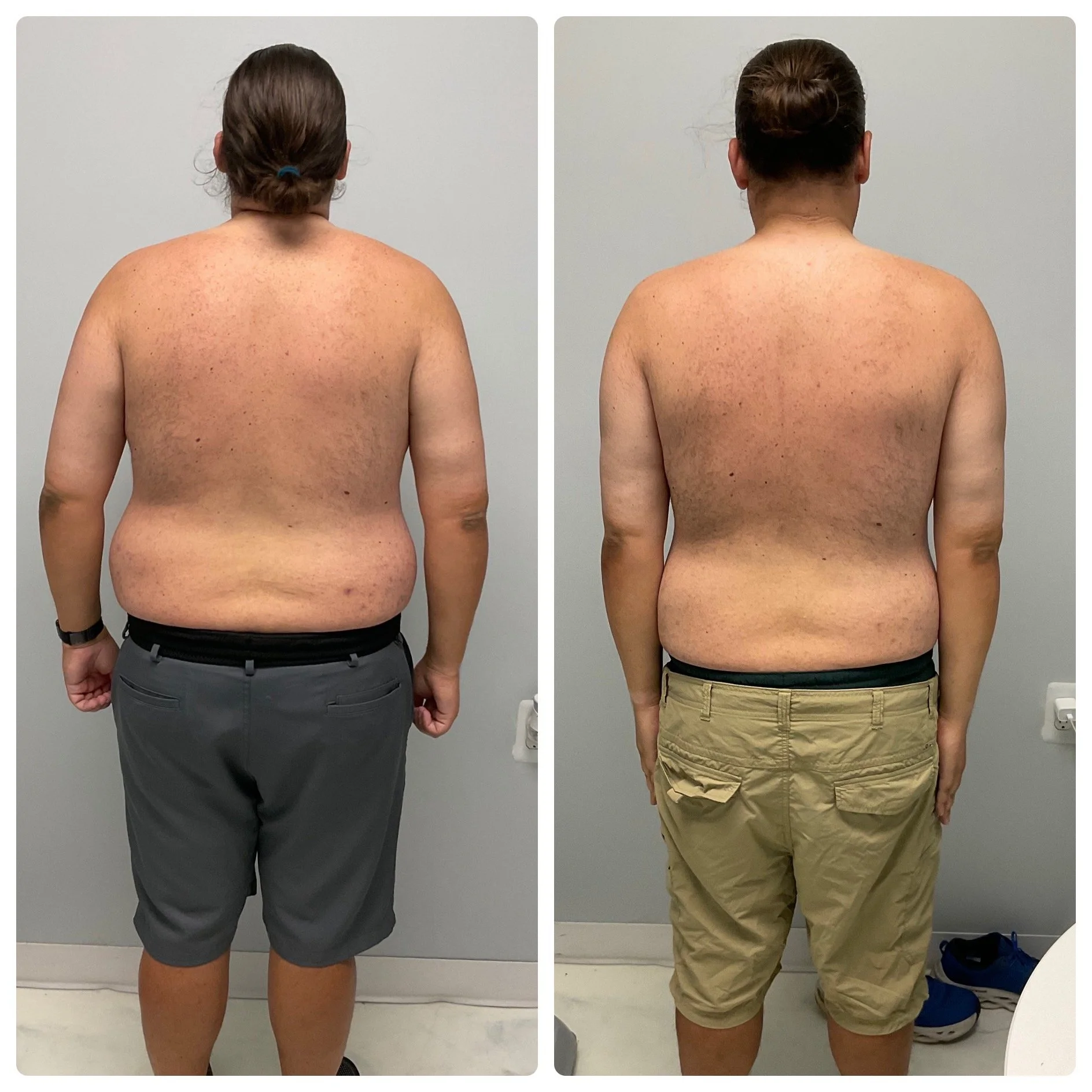 male-back-progress-metrowest-personal-training.jpg.JPG