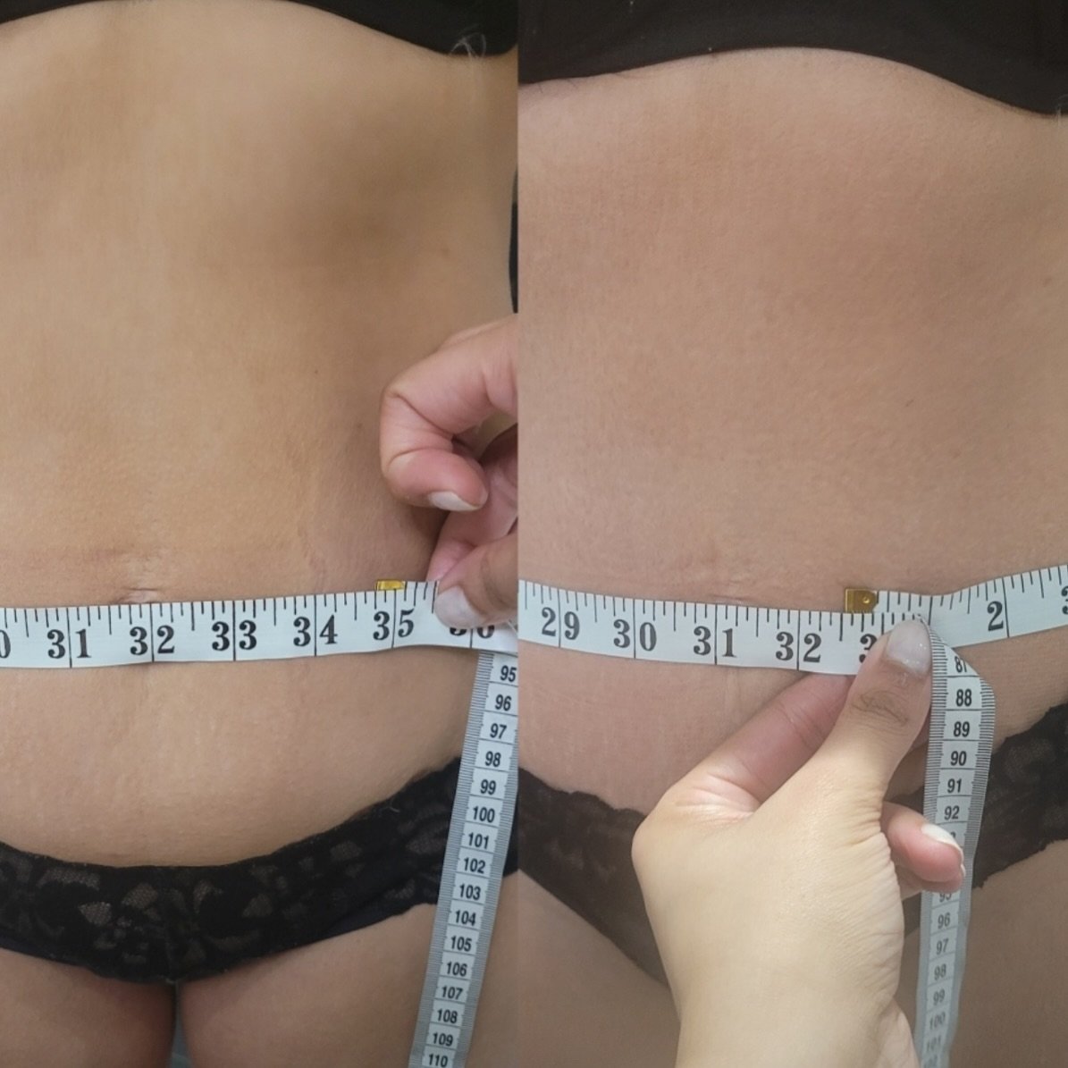 Watching the inches melt off every week! Are you ready for summer!? 

✅ DM to book your appointments
✅ DM about our machine &amp; training 

#tummytuck #nonsurgical #nonsurgicaltummytuck #inchloss #skintightening #collagen #cavitation #radiofrequency