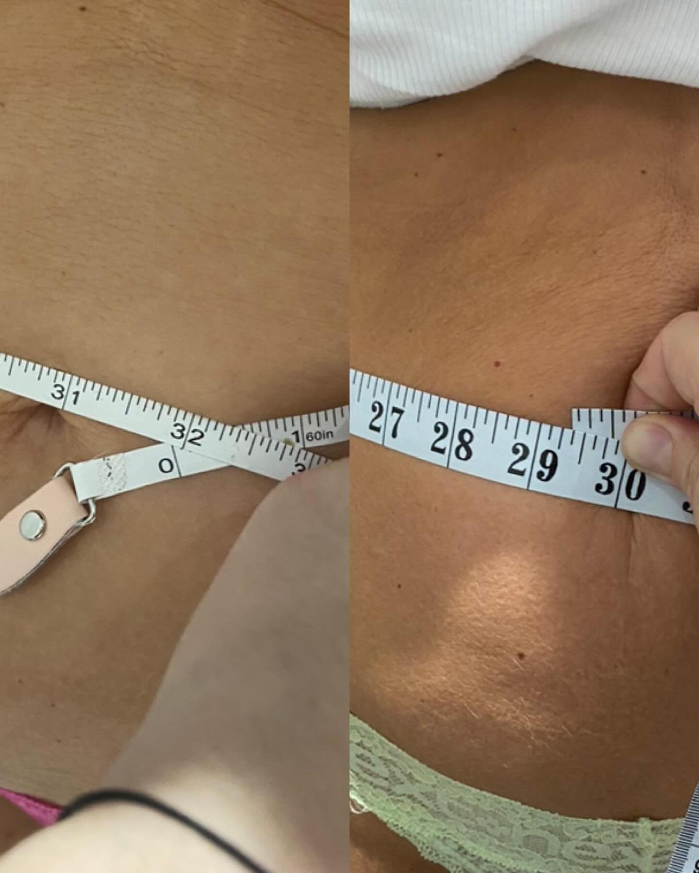 5 inches total loss and a flatter tummy for summer!! 🙌

Book your tummy tuck 5 week course 💛 

✅ DM to book your appointments
✅ DM about our machine &amp; training 

#tummytuck #nonsurgical #nonsurgicaltummytuck #inchloss #skintightening #collagen 