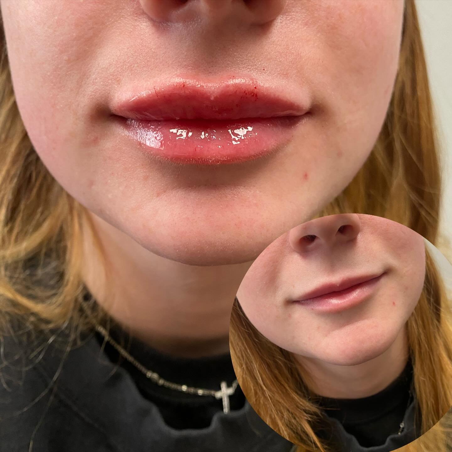 A little lip boost for the W.