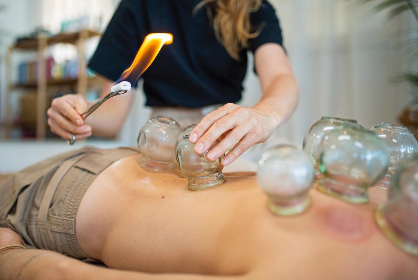 Have you ever experienced the powerful effects of cupping? 🌿

This ancient therapy has deep roots in Traditional Chinese Medicine 🌿

It&rsquo;s great to stimulate the flow of Qi (energy), and to help remove stagnation (stuck energy) 🌿

Perfect to 