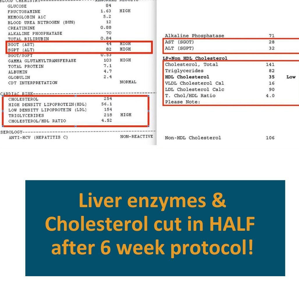 After 6 weeks of dedicated changes in Dennis&rsquo; lifestyle, nutrition, and habits - WOW to see these numbers come back!!! At 31 years old, a past collegiate athlete, generally healthy (or so he thought), he&rsquo;s the typical office work job with