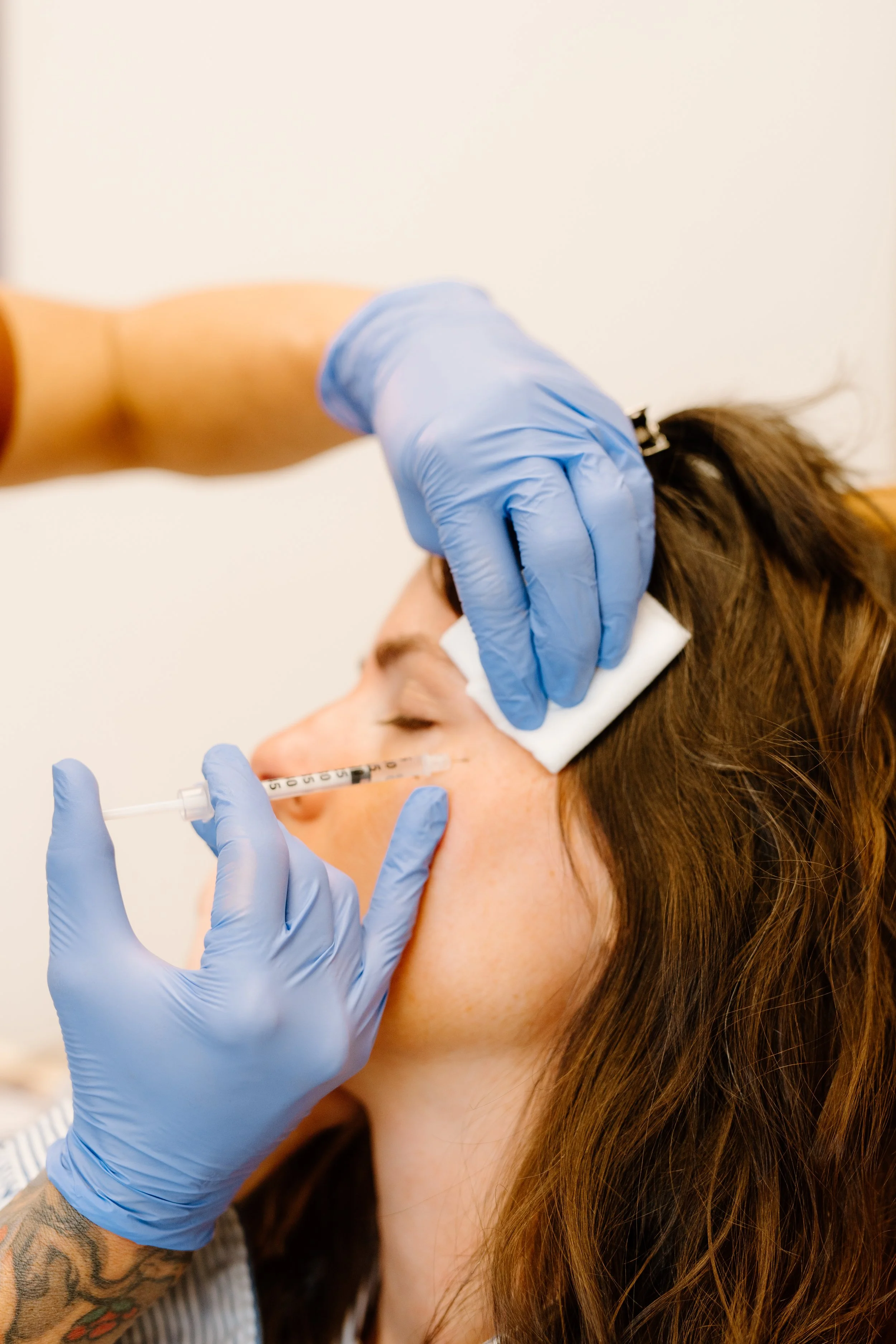 Filler at Alpine Aesthetic and Wellness Reno