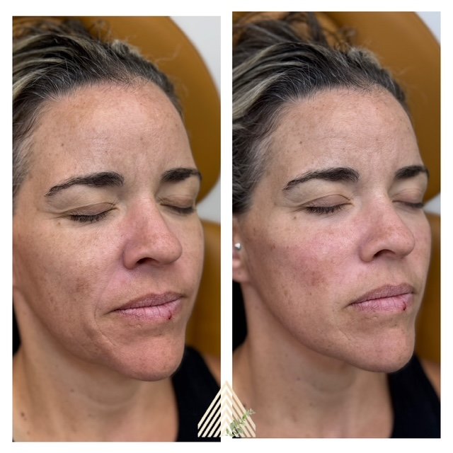 full face balancing.JPG