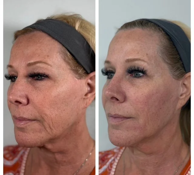 full face balancing.JPG