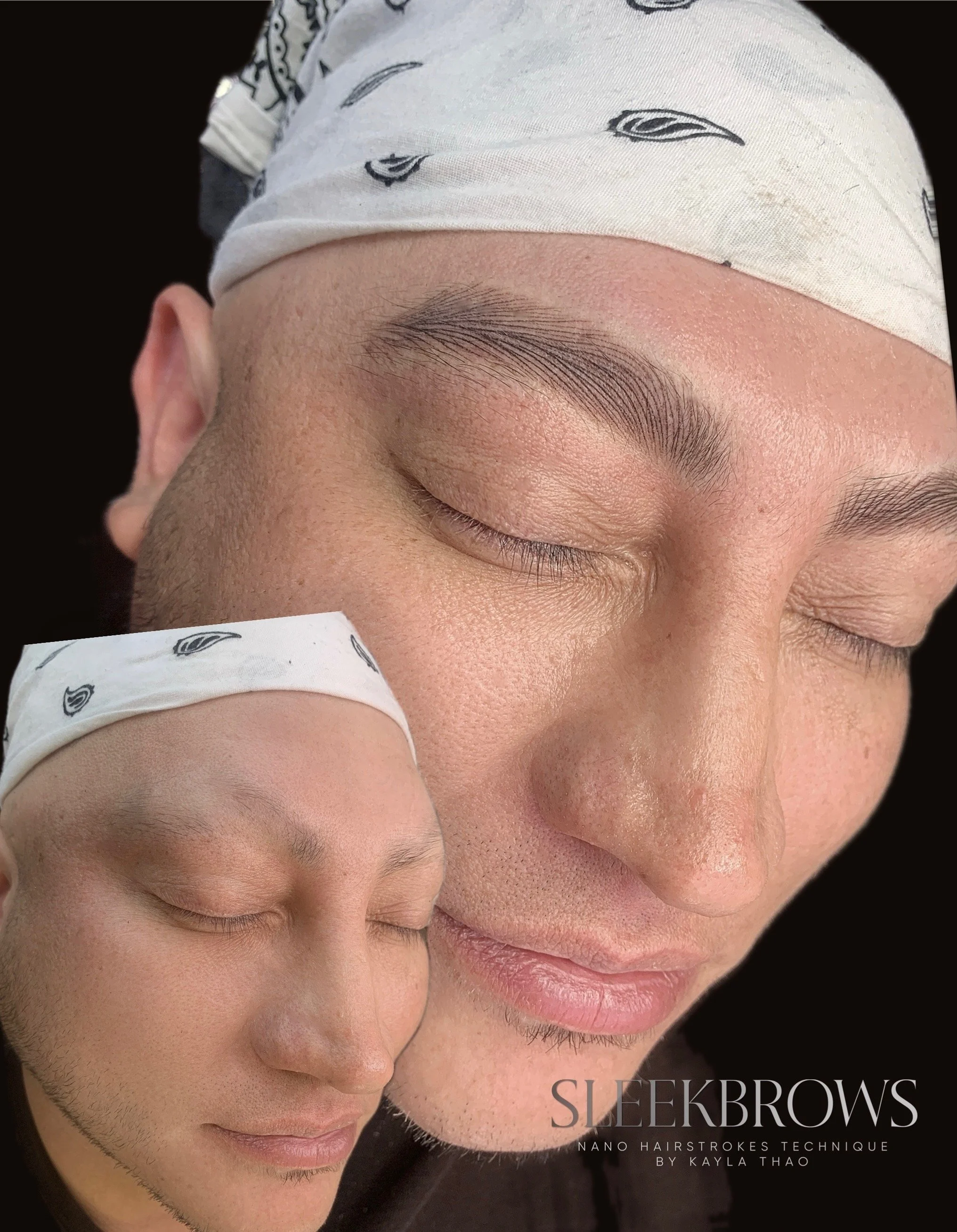 Alopecia Nano Brows