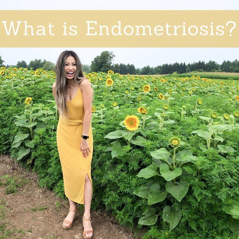 Endometriosis is a health condition where tissue similar to uterus grows outside the uterus. The exact cause of this is unknown, but there are a few theories. Some signs and symptoms that can be experienced are painful: periods / intercourse / bowel 