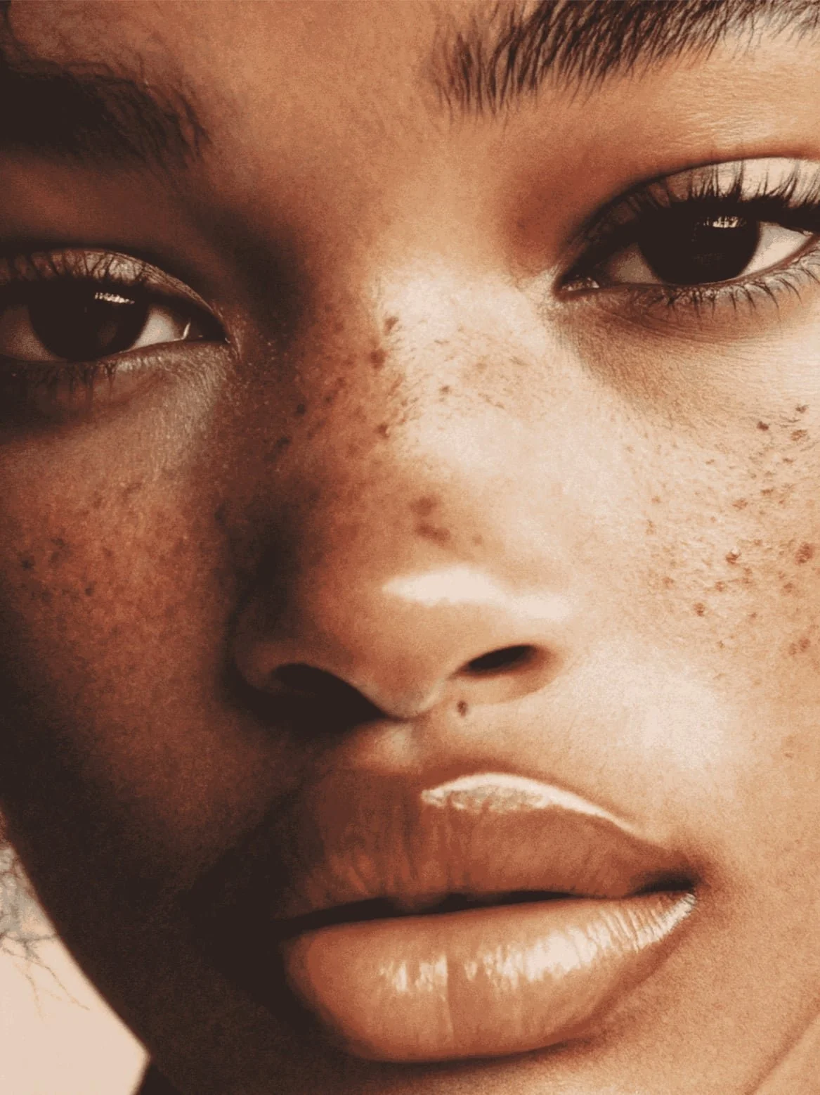 freckles moles skin check african american skin doctors cary
