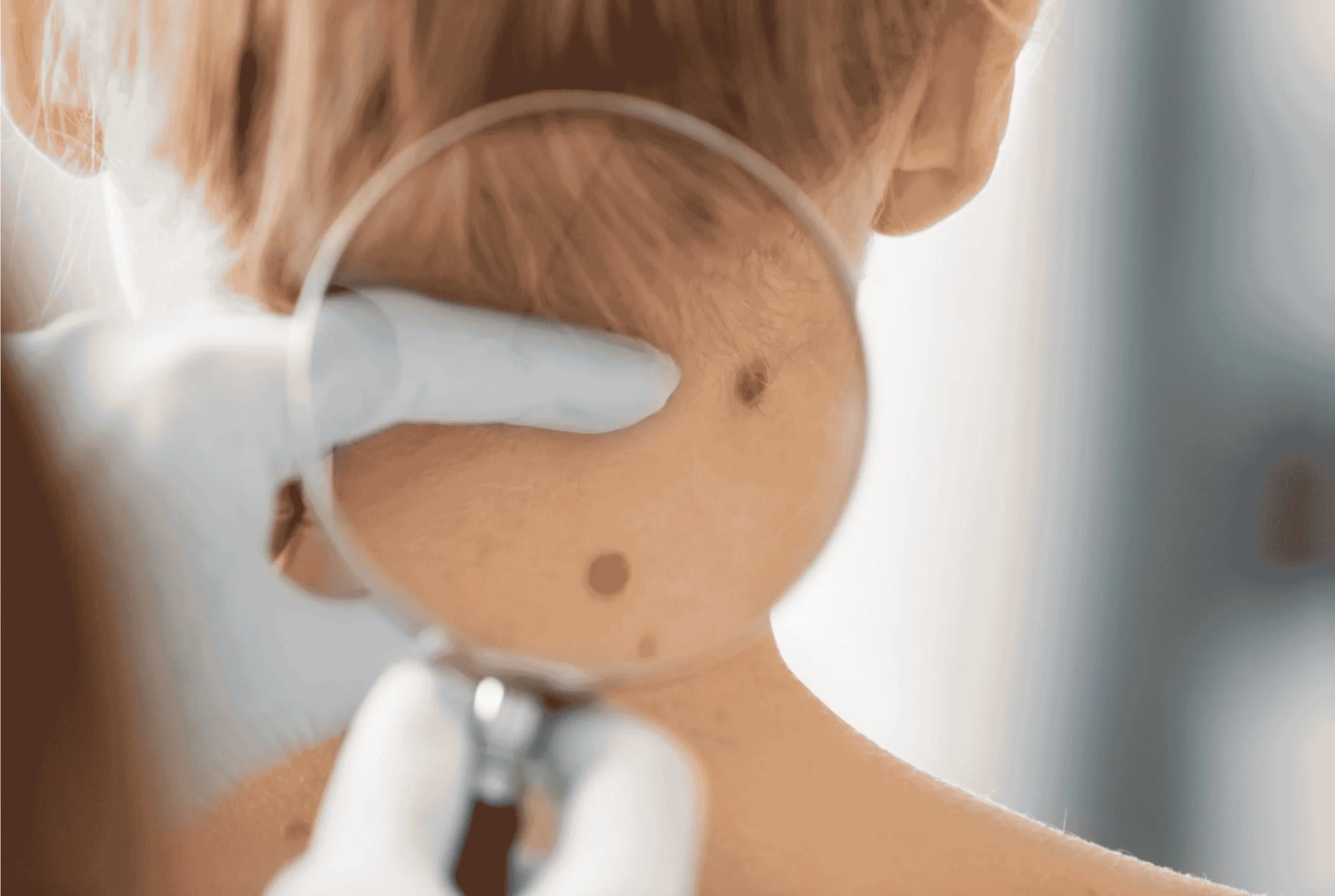 mole check, skin doctor, cancer screening, cary, raleigh, dermatologist