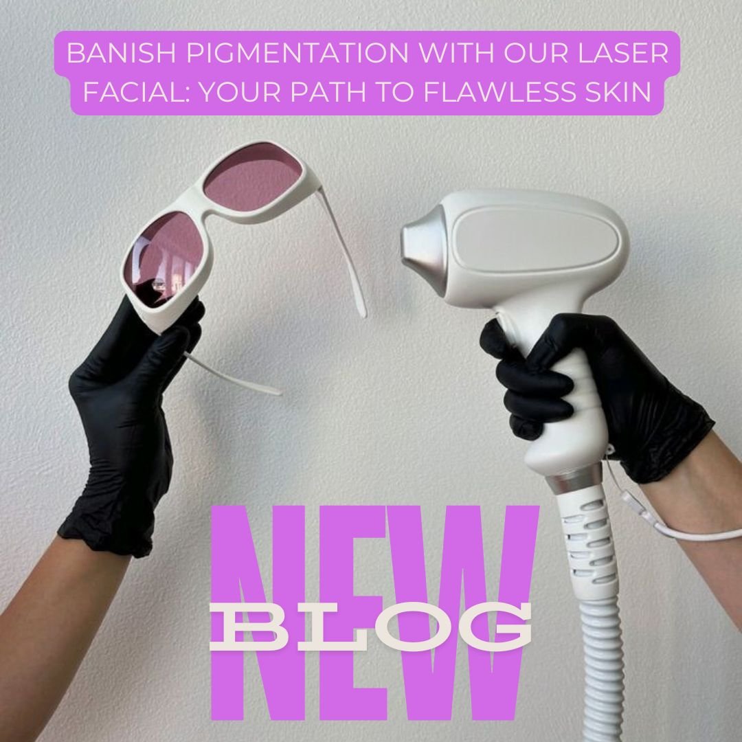 Banish Pigmentation with Our Laser Facial: Your Path to Flawless Skin