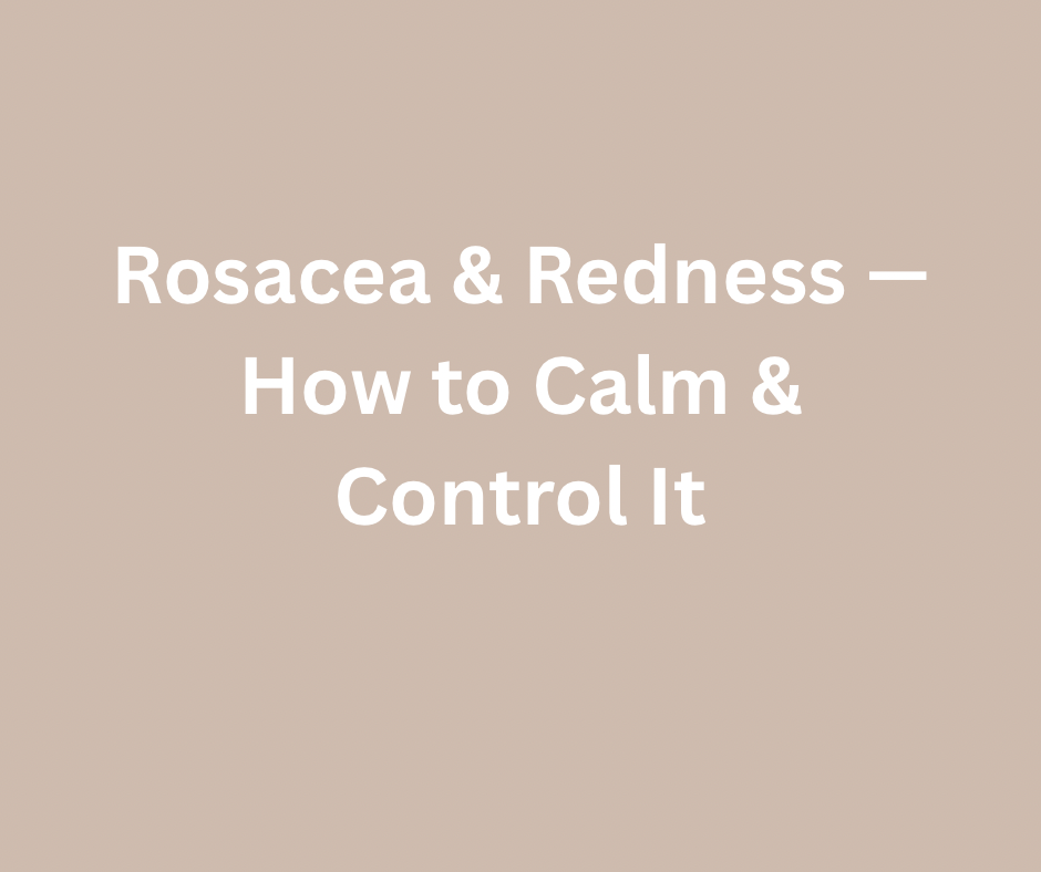 Rosacea & Redness — How to Calm & Control It