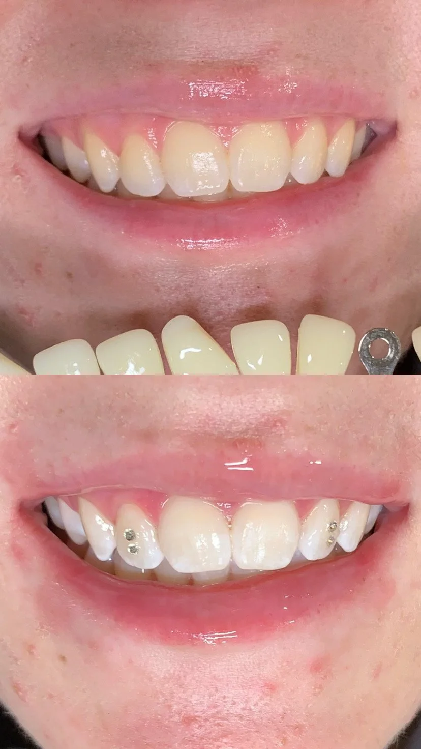 sydney tooth gems, adelaide tooth gems, tooth gem course, tooth gem training, teeth whitening sydney, teeth whitening adelaide, teeth whitening sydney, tooth gem education, tooth gem course