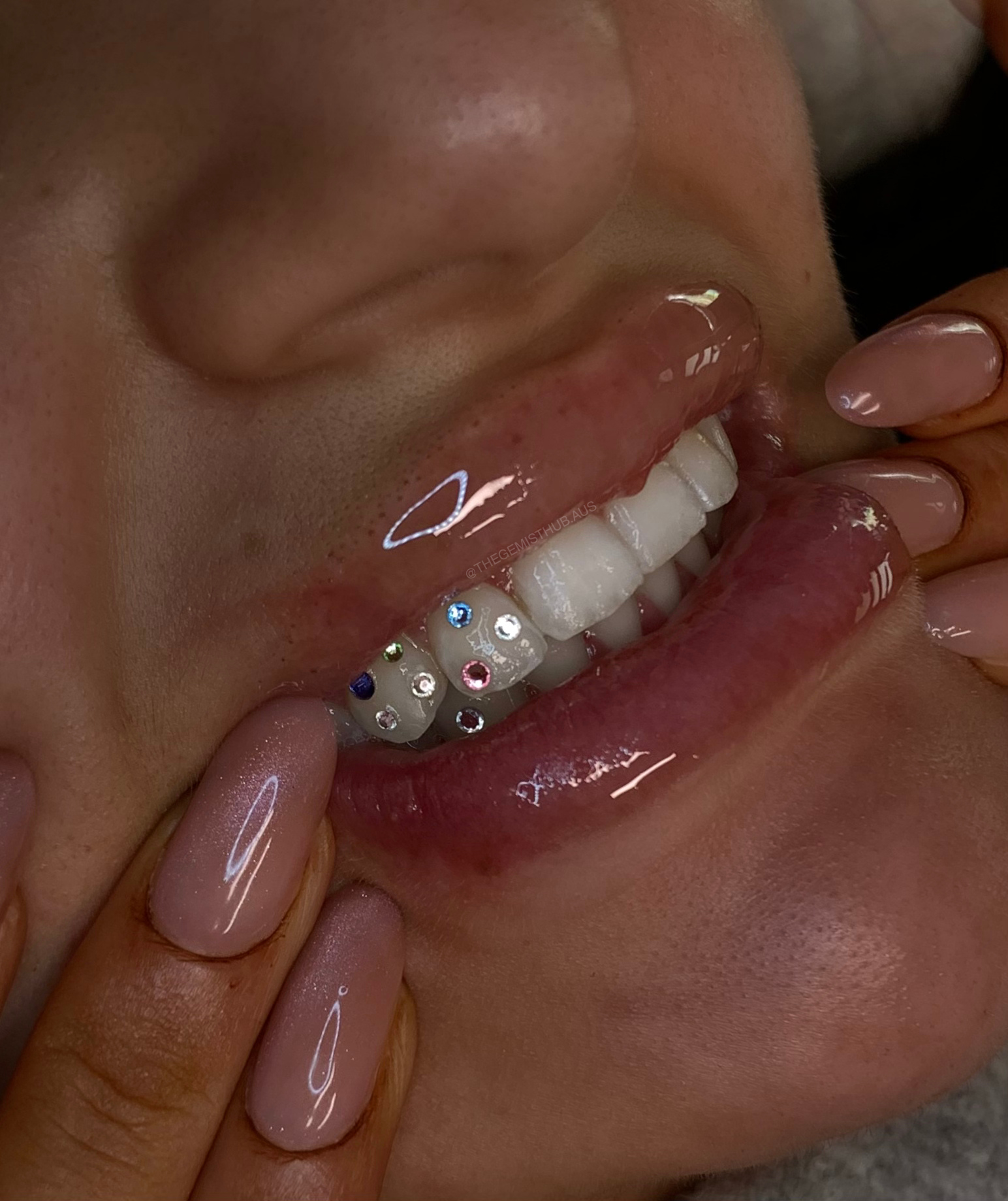 sydney tooth gems, adelaide tooth gems, tooth gem course, tooth gem training