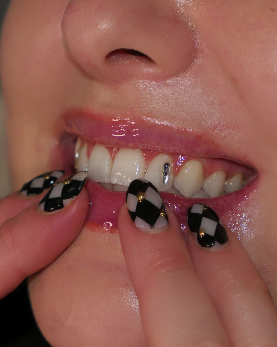 sydney tooth gems, adelaide tooth gems