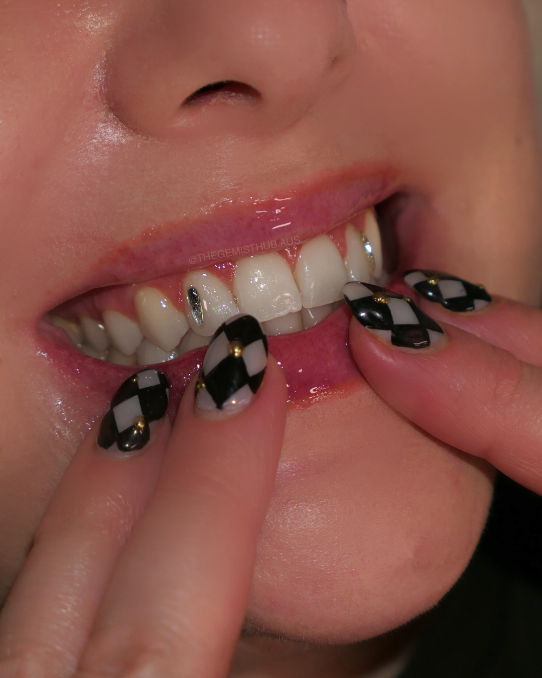 Sydney tooth gems, adelaide tooth gems