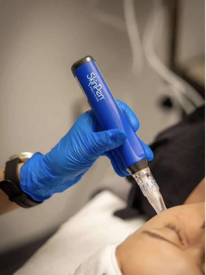 SkinPen Microneedling
