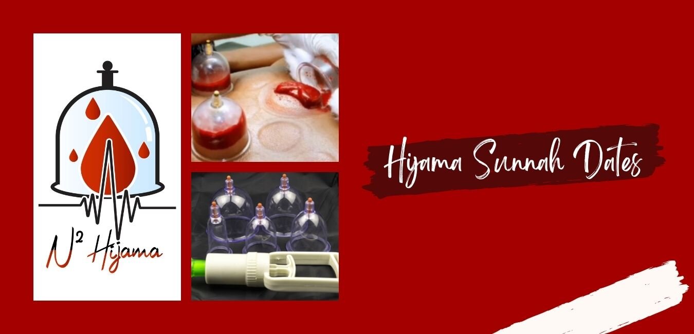 Hijama Sunnah Dates