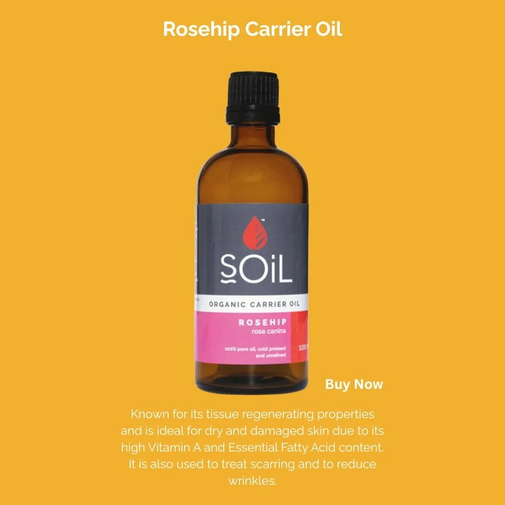 A bottle of Soil Organic Carrier Oil with a black cap and pink label, labeled as Rosehip (rosa canina), on a yellow background with white text promoting its benefits for skin regeneration, dry and damaged skin, scars, and wrinkles. The text also includes a purchase prompt, "Buy Now."