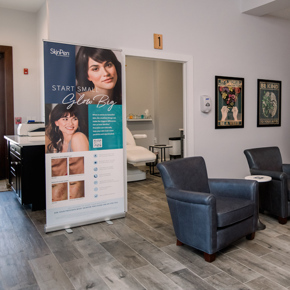 SkinPen at Good Vibe Medical