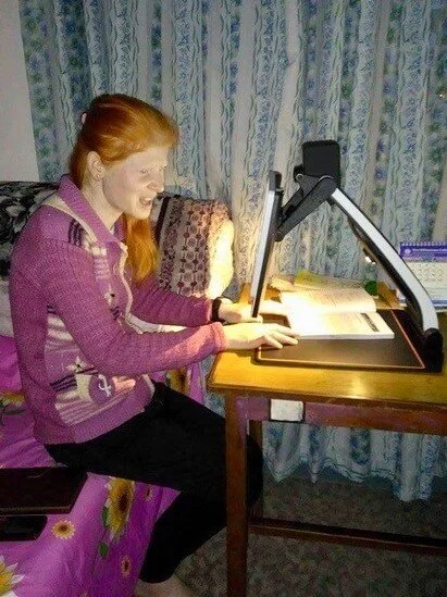 Helping Puja: A Magnalink Zip For Low Vision And Nystagmus