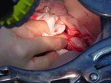 s4small.gif