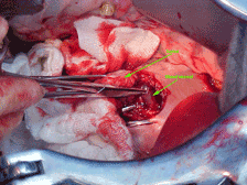 s6small.gif