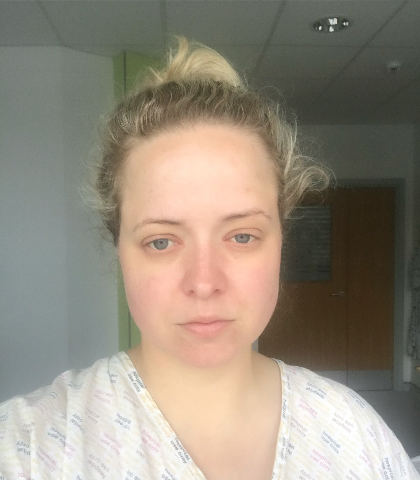 3 years ago today 📷 A selfie from Pembury Hospital after starting IV antibiotics for SEPSIS ⚡️Drs had no idea where the primary infection was and I was loosing the battle quickly. I was insistent that they keep communicating with my Cardiac Consulta