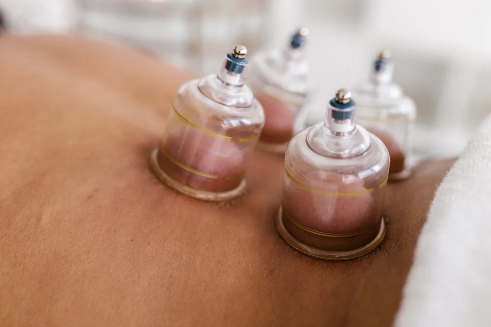 Hydrotherapy consultation & cupping