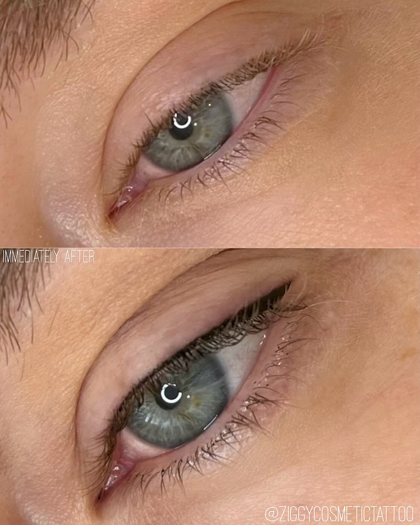 before + immediately after eyeliner tattooing 🖊️ by Jess @ziggycosmetictattoo

Each liner is 100% customised to the wearer after a thorough consultation + designing process (not to mention, with a gal with over 10+ years in makeup and permanent make