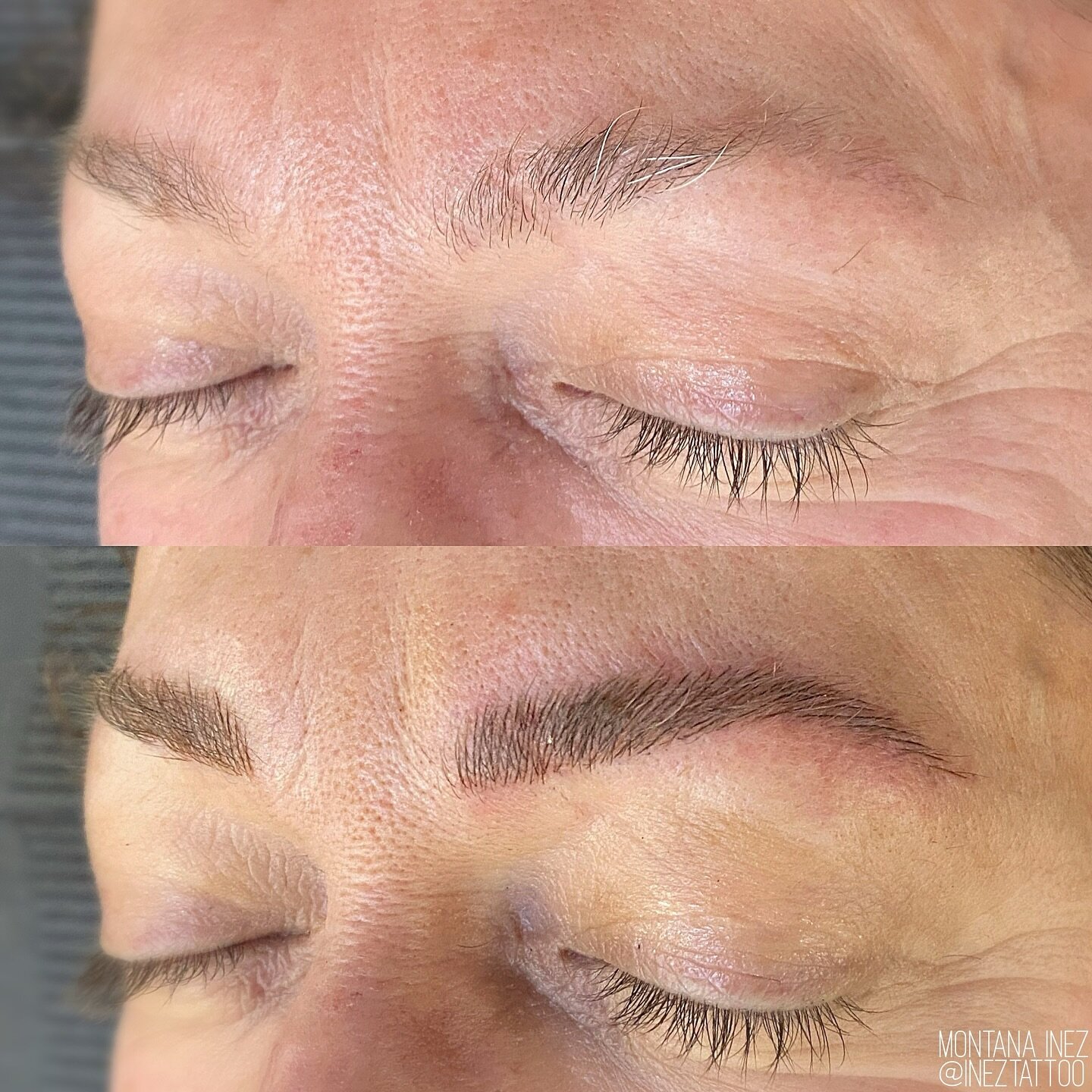 childhood scars and white hairs, be gone! ✨

before + immediately after microblading

&ldquo;what will my white/grey/blonde brow hairs look like with microblading?&rdquo; is a super common question we get!

the white hairs are still there in the afte