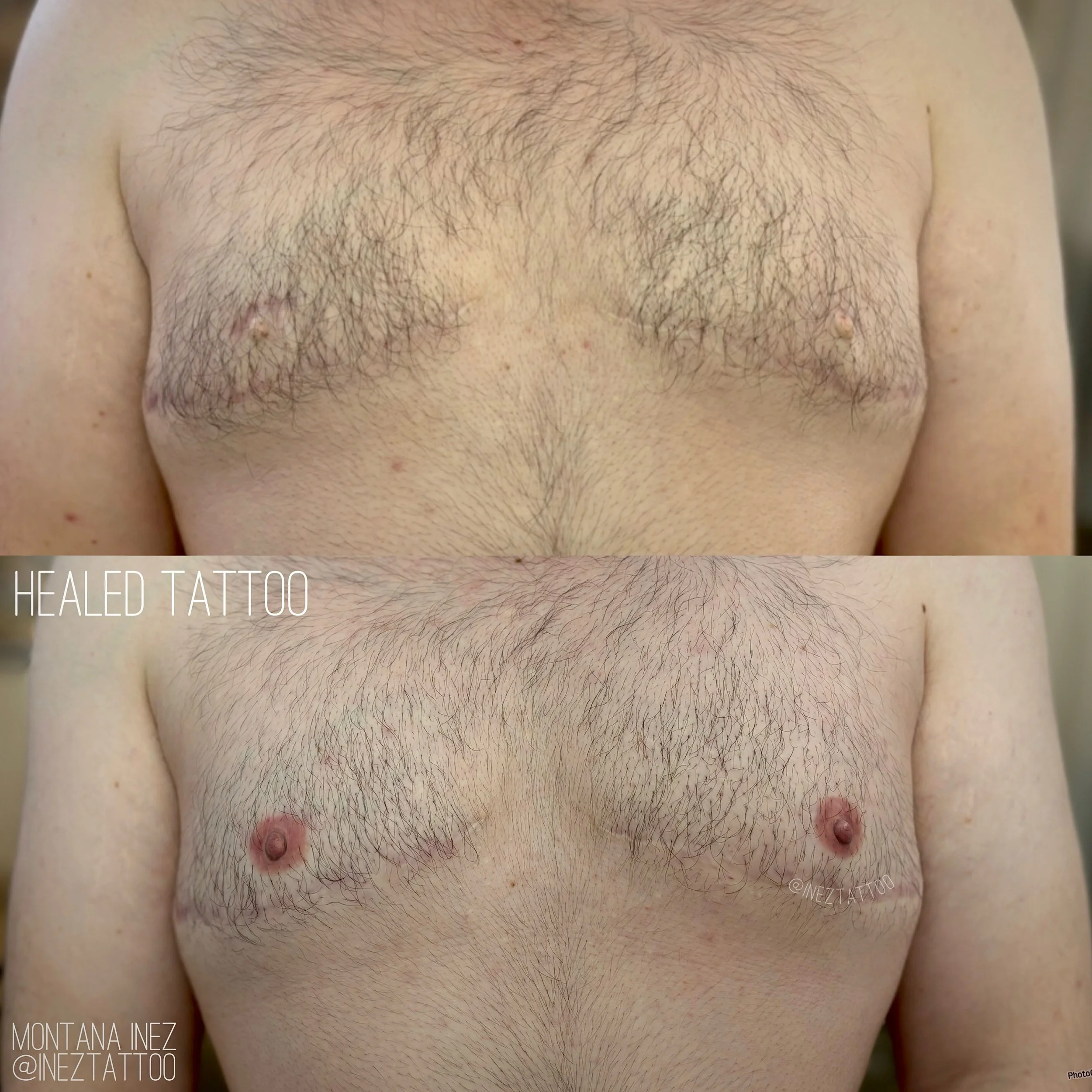Healed restorative tattoos, for my awesome client post top surgery ✨🖤
Thank you so much for your trust!

After the bottom photo was taken, a small touch up was done to further refine the results. There was some scar tissue within the areola that nee