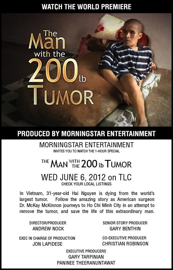 Man with 200Lb Tumor - Documentary