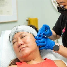 Non-Surgical PDO Thread Lifts
