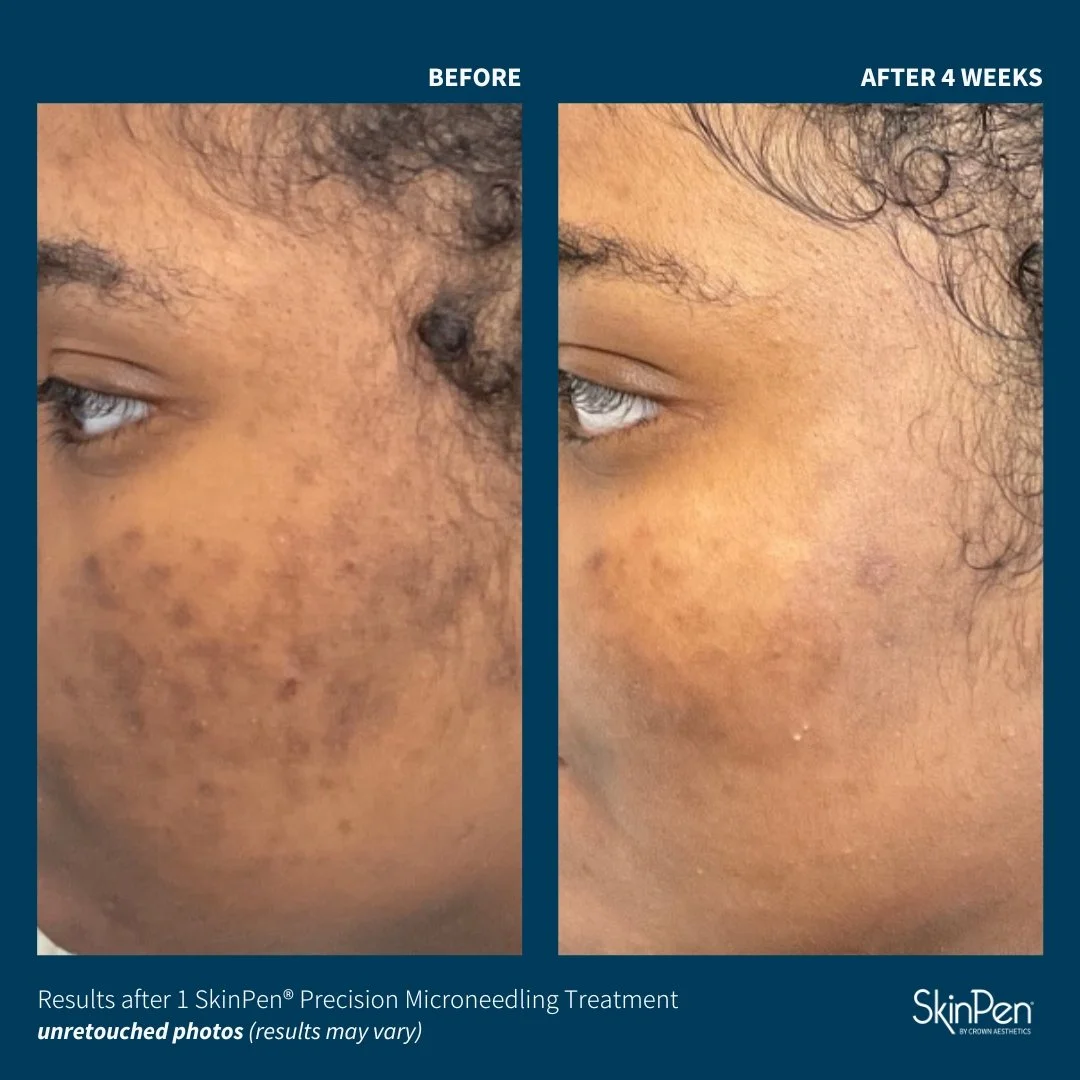 Web_ProvenanceAddison S Before and After .jpg