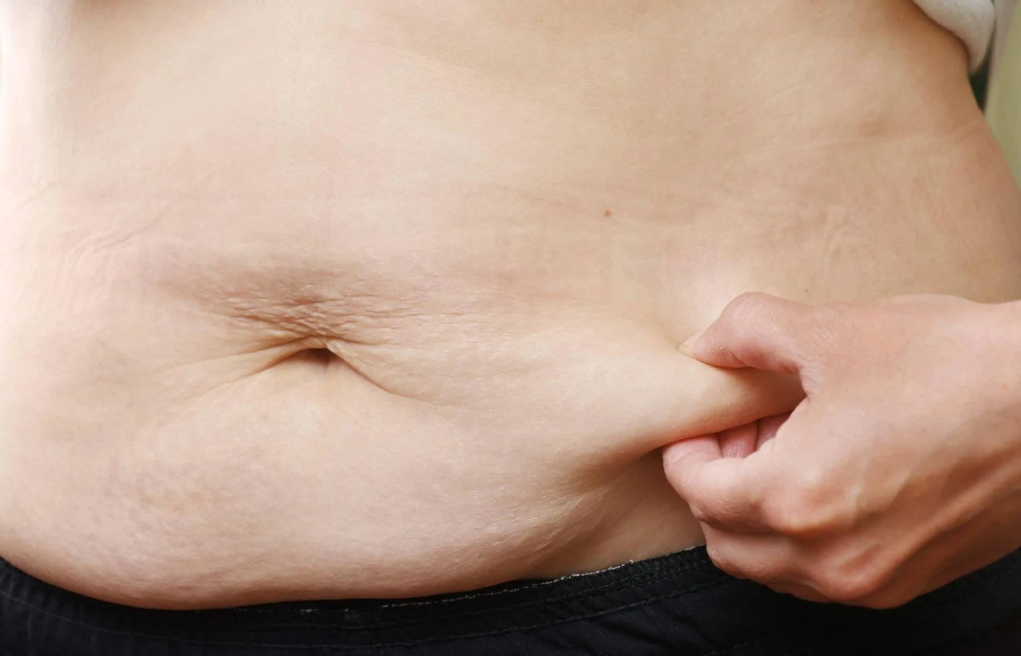 What Causes Menopause Belly Fat? Why Your Diet Isn't Working During or After Menopause